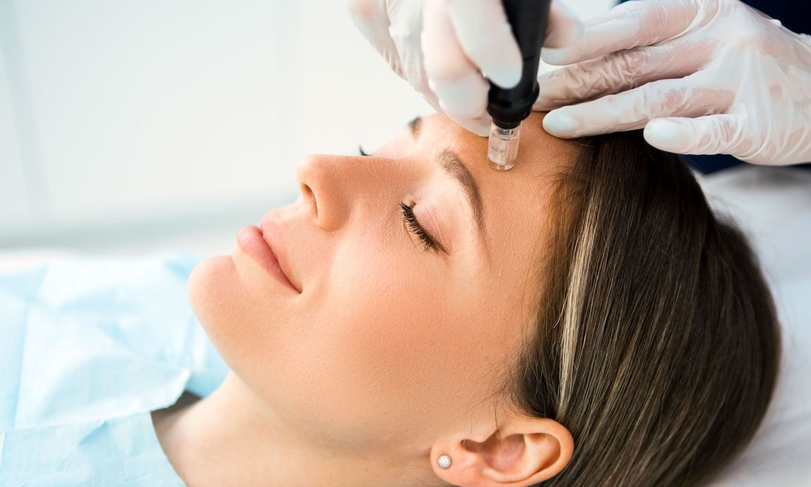 Microneedling icon